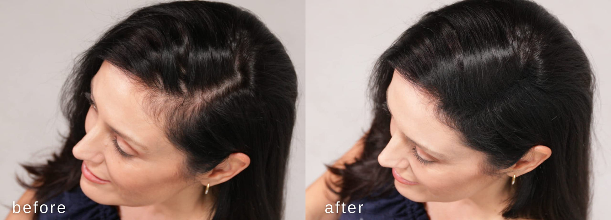Włókna Zagęszczające Włosy Luxe - Zaufanie W Słoiku - 2 Miesiące + Dostawa! - Hipoalergiczny, Przetestowany Dermatologicznie - Dostępne W Wielu Kolorach (Czarny)