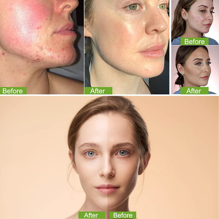 Poduszka Grzyb CC Krem, Głowa Grzyba Poduszka Powietrzna BB Kremowy, CC Krem, Korektor Trwały Nude Makijaż Nawilżający Rozjaśniający (Naturalny)