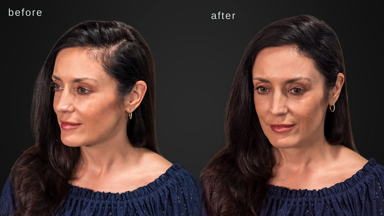 Włókna Zagęszczające Włosy Luxe - Zaufanie W Słoiku - 2 Miesiące + Dostawa! - Hipoalergiczny, Przetestowany Dermatologicznie - Dostępne W Wielu Kolorach (Czarny)