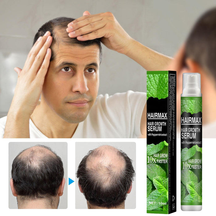 Anti Hair Loss S_pray, Hair Growth Treatment, Prevent Hair Loss Care Mint Extract Growing Hair serum, Hair Growth Treatment Wuwai