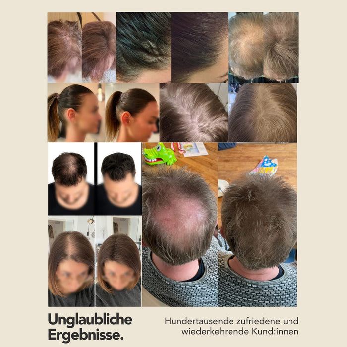 Imperio - preparat do zagęszczania włosów w ciągu kilku sekund. Kuracja dla włosów jak w salonie premium dla autentycznego wyglądu. Dobrze wzmacnia, 100% naturalna jakość.