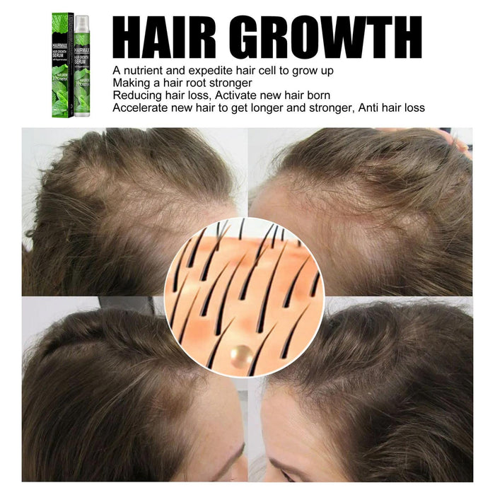 Anti Hair Loss S_pray, Hair Growth Treatment, Prevent Hair Loss Care Mint Extract Growing Hair serum, Hair Growth Treatment Wuwai