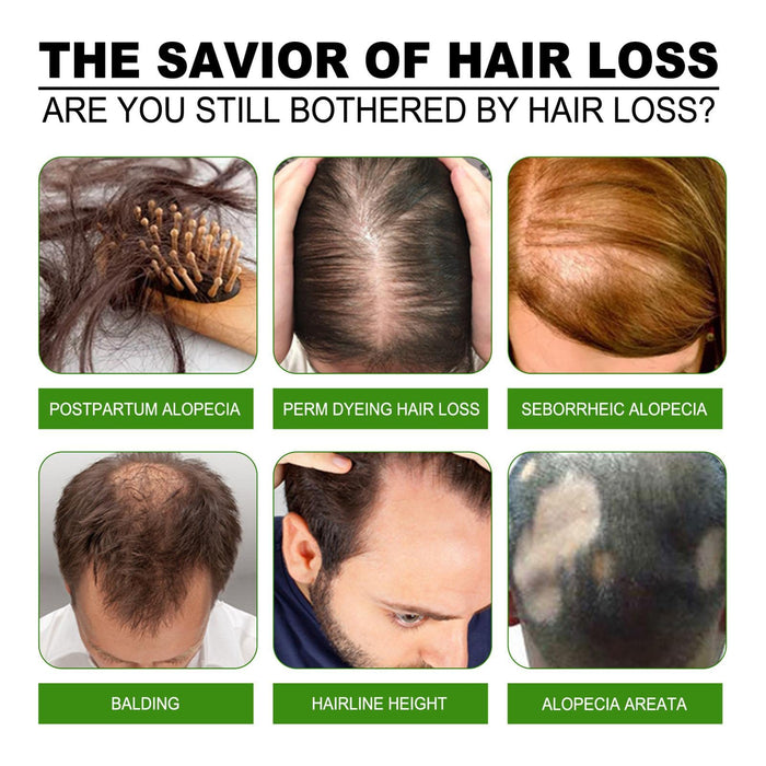 Anti Hair Loss S_pray, Hair Growth Treatment, Prevent Hair Loss Care Mint Extract Growing Hair serum, Hair Growth Treatment Wuwai