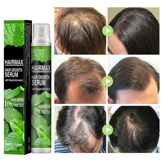 Anti Hair Loss S_pray, Hair Growth Treatment, Prevent Hair Loss Care Mint Extract Growing Hair serum, Hair Growth Treatment Wuwai