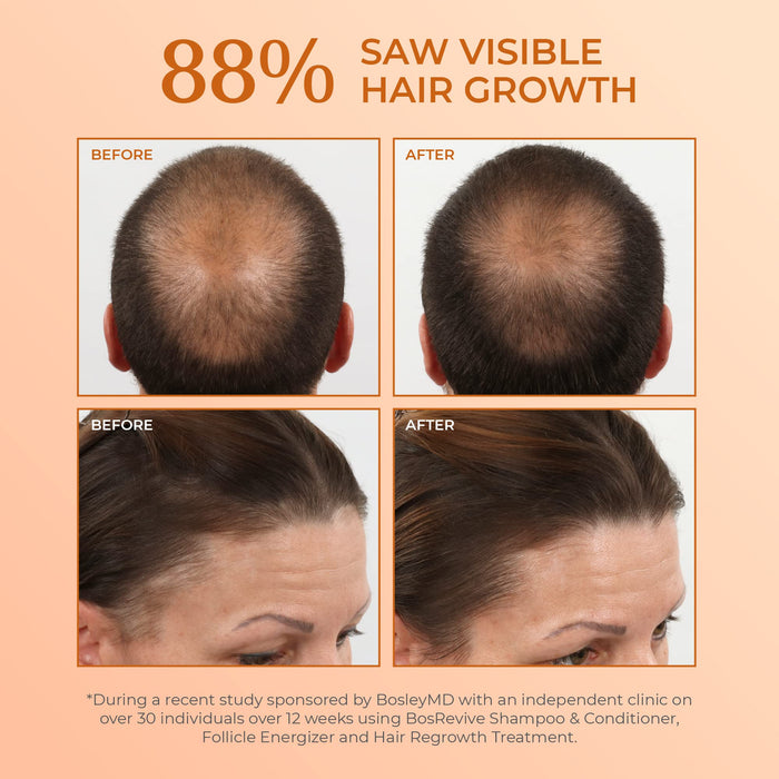 Bosley MD BosRevive Color Safe Volumizing Conditioner 1x 300ml