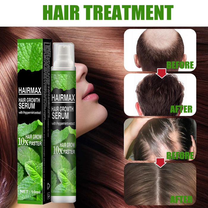 Anti Hair Loss S_pray, Hair Growth Treatment, Prevent Hair Loss Care Mint Extract Growing Hair serum, Hair Growth Treatment Wuwai